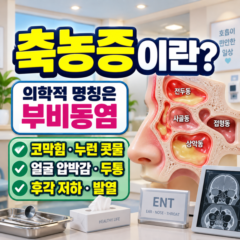 축농증(부비동염) 증상, 코막힘·누런 콧물에 두통까지? 원인·치료·약·수술 총정리