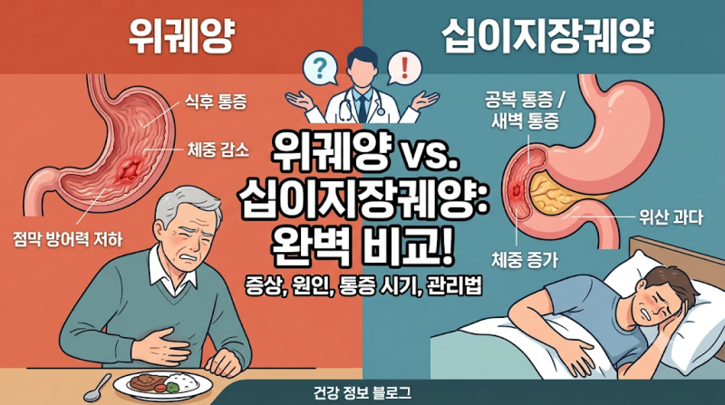 식후 속쓰림 vs 공복 속쓰림? 위궤양과 십이지장궤양의 결정적 차이