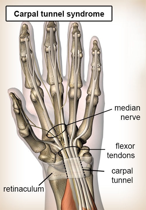 손목 터널 증후군 손목 수근관 증후군 Carpal tunnel syndrome: 의료진, 병원, 연구자 디렉토리 2026