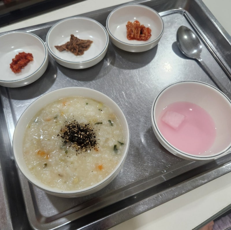 내치핵 치질 수술 2일차 / 퇴원 야호~ 생각보단 괜찮다