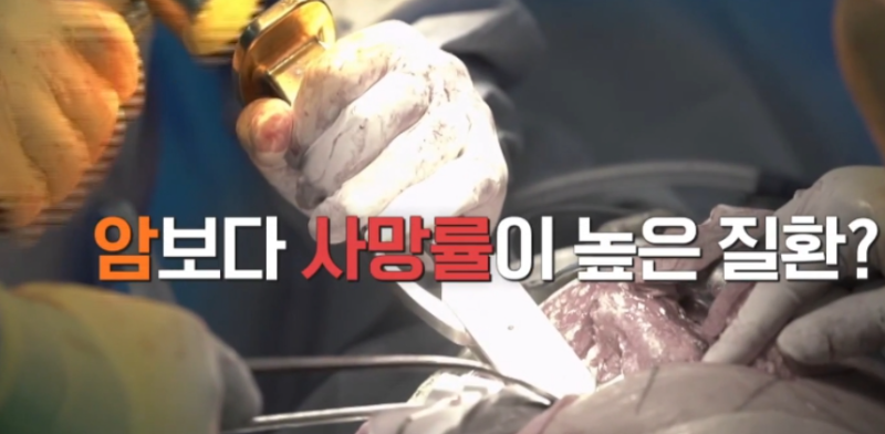 EBS 명의 김범준 교수 병원 어디? 서울아산병원 골다공증 최신 치료제와 뼈 건강 관리법