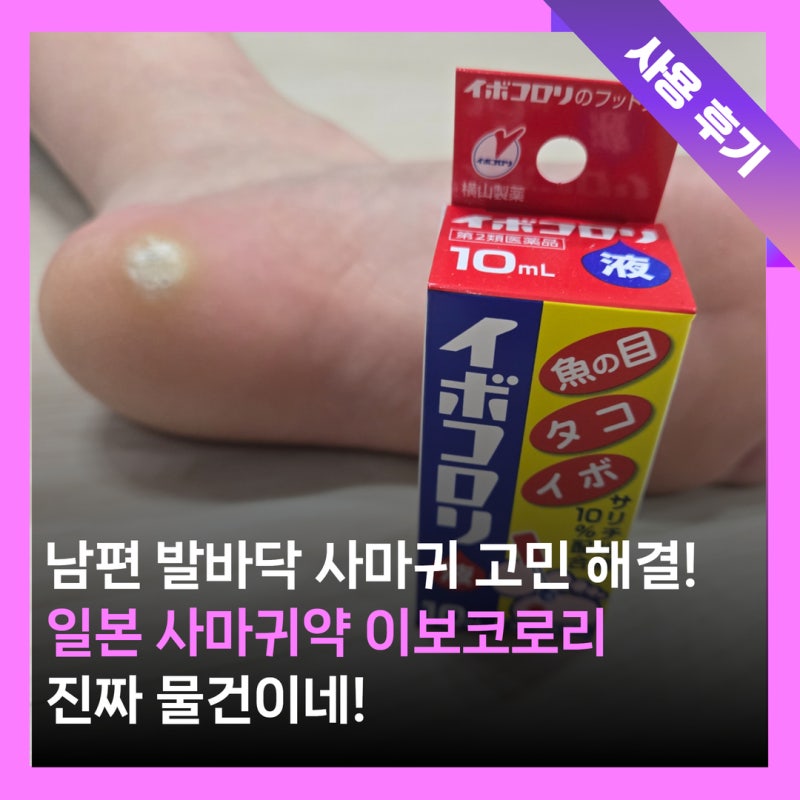 일본 사마귀약 티눈약 이보코로리 바르는 액체 타입 추천