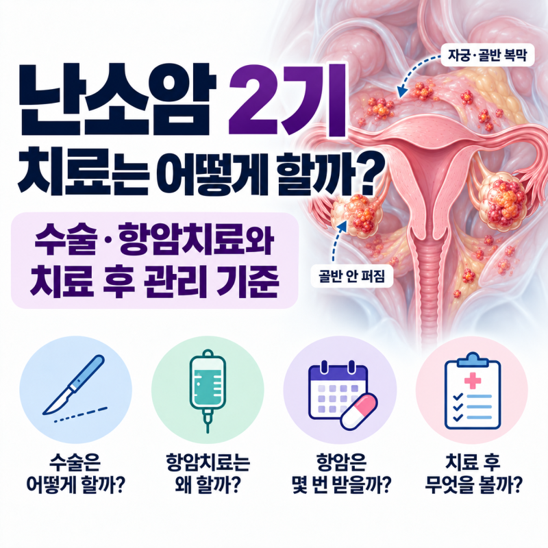 난소암 2기 치료는 어떻게 할까? 수술·항암치료와 치료 후 관리 기준