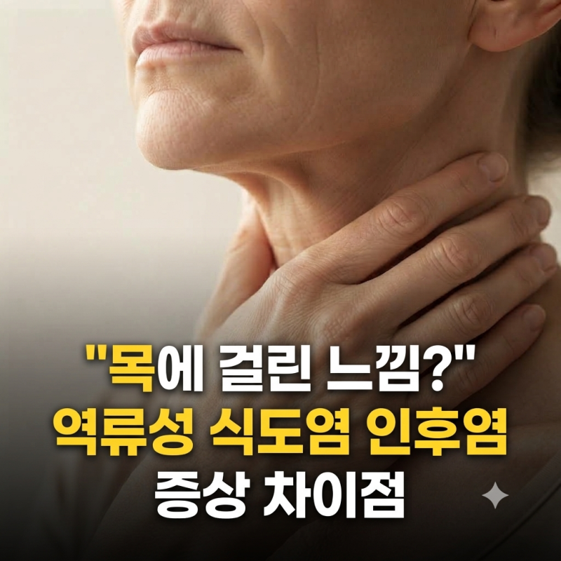 "목에 걸린 느낌?" 역류성 식도염 인후염 증상 차이점