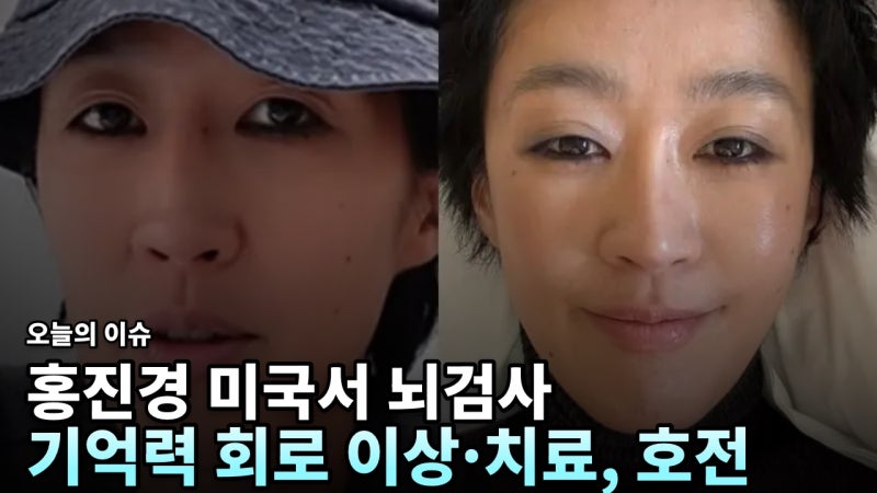 홍진경, 기억력 문제로 美서 뇌 정밀검사…회로 이상 진단 후 일주일 치료로 호전