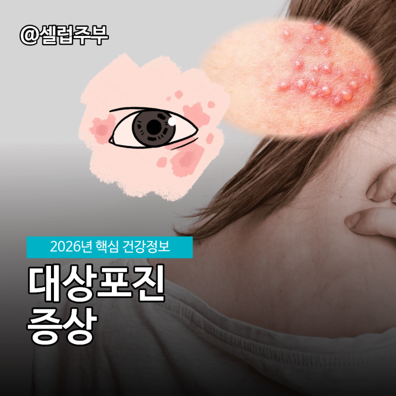 대상포진 의심될때 증상, 병원 어디로 가야할까?