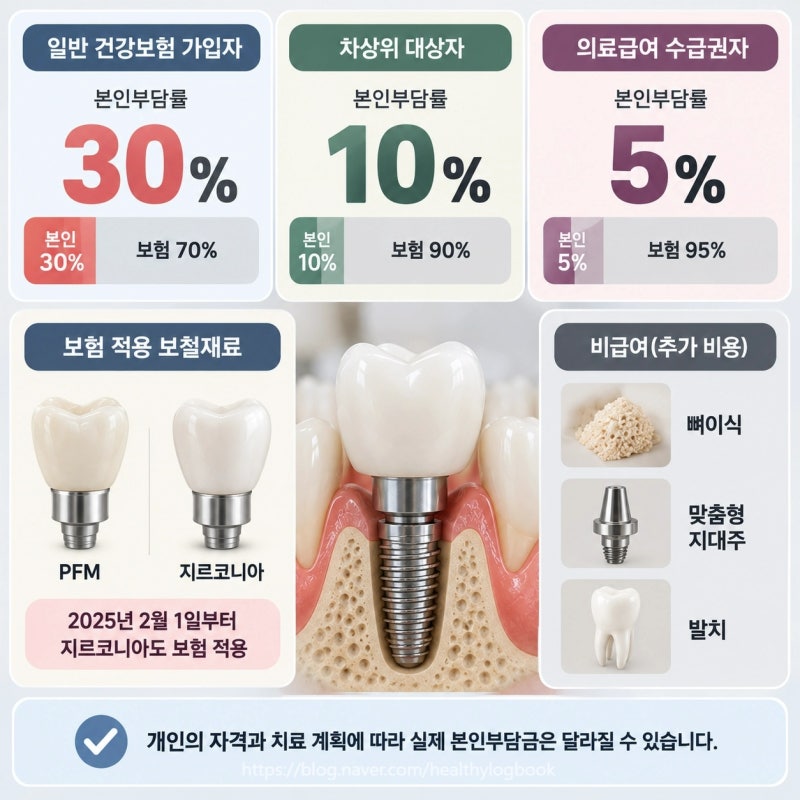 임플란트 비용 얼마일까? 1개 가격부터 65세 이상 건강보험까지