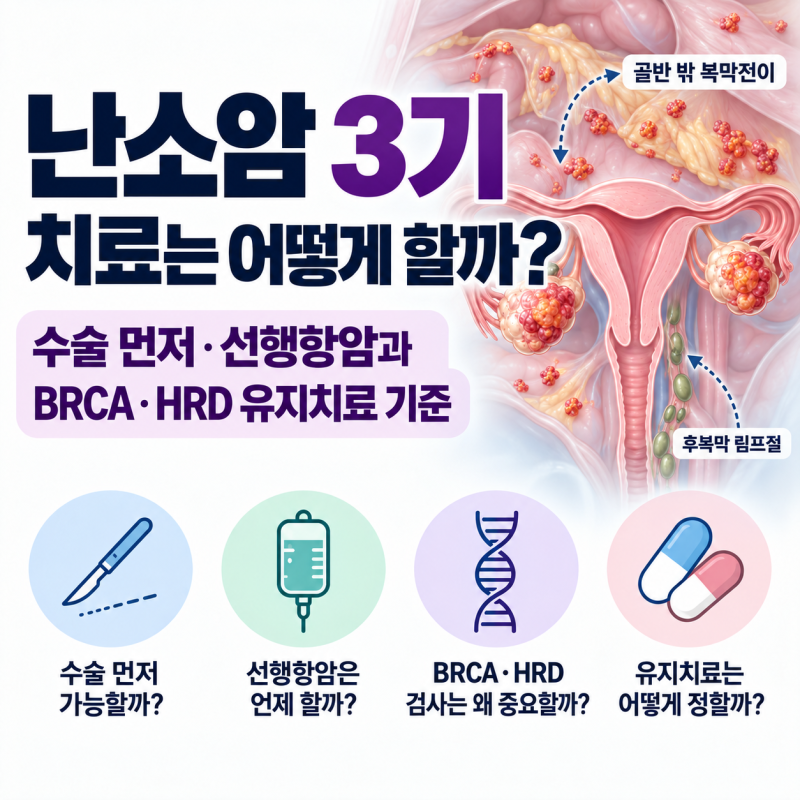 난소암 3기 치료는 어떻게 할까? 수술 먼저·선행항암과 BRCA·HRD 유지치료 기준