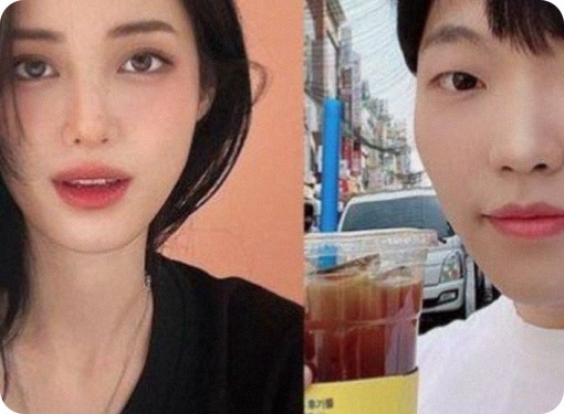 최고기 재혼 가슴 유깻잎 재수술 솔잎 언급 관계