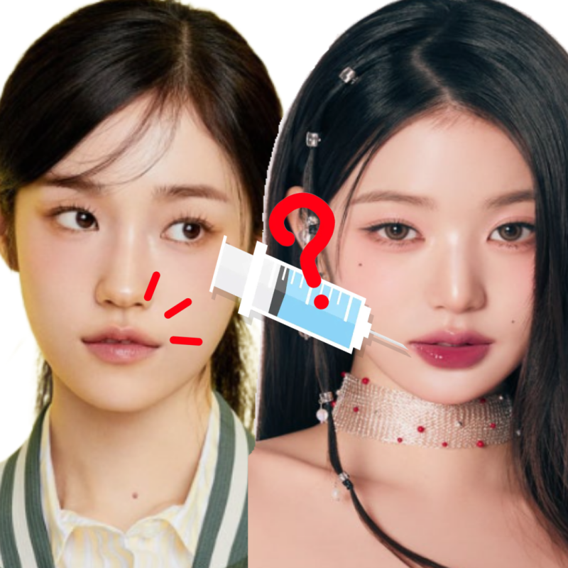 像張員瑛、盧允瑞一樣漂亮上揚的嘴角，透過醫美也能實現嗎？