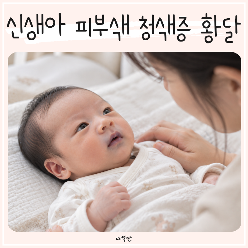 신생아 피부색이 노랗거나 파래요? 아기 청색증 황달과 모유수유 체크