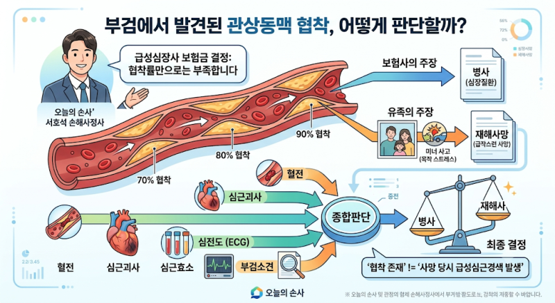 급성심장사 부검에서 관상동맥 70%·80%·90% 협착이 발견됐다면
