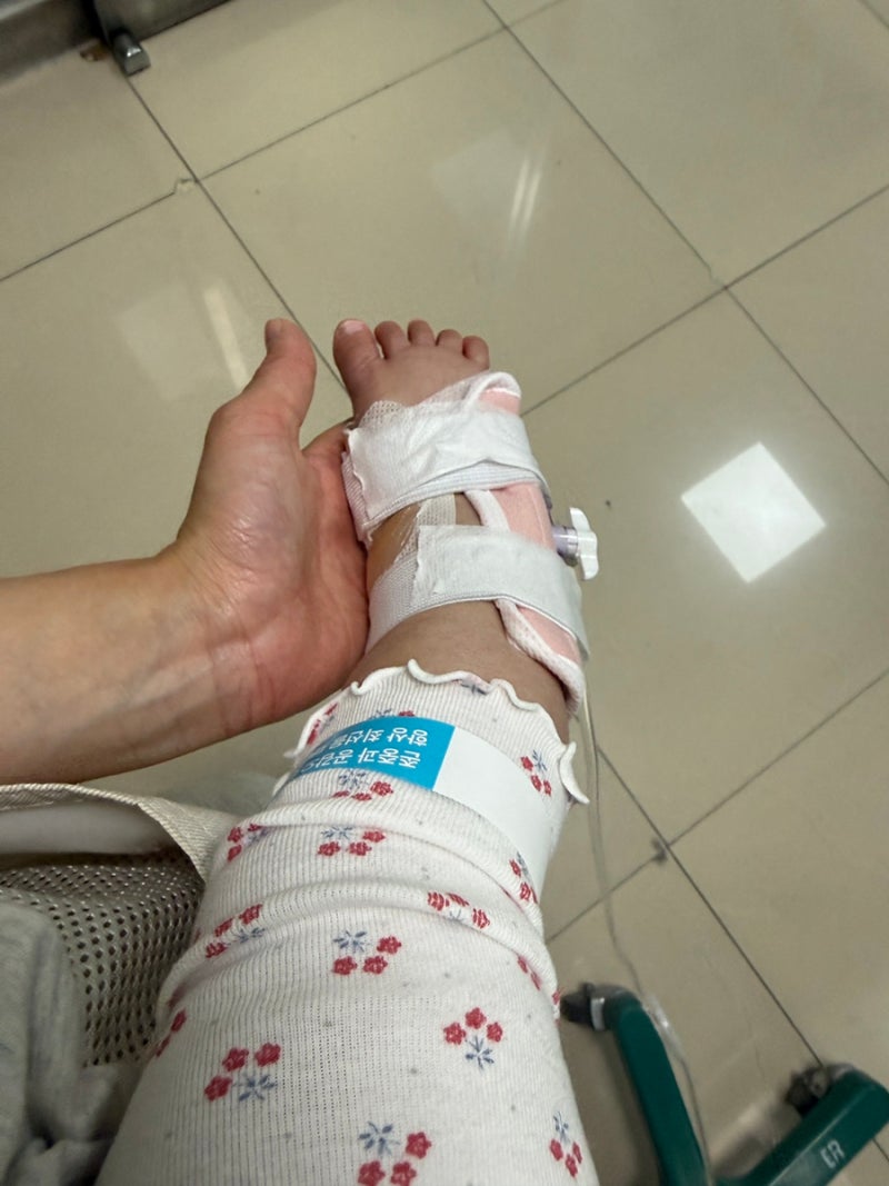 아기 계란 알러지 분수토 fpies