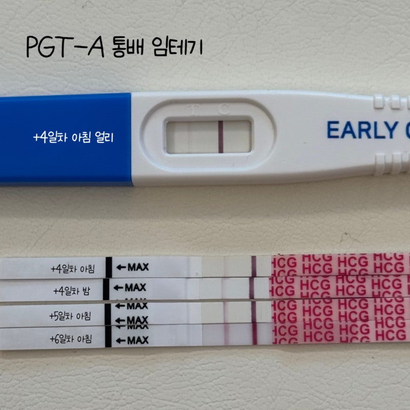 40대 시험관 PGT-A 통배 이식 4~6일차 증상｜희미한 두줄, 조금씩 진해지는 임테기