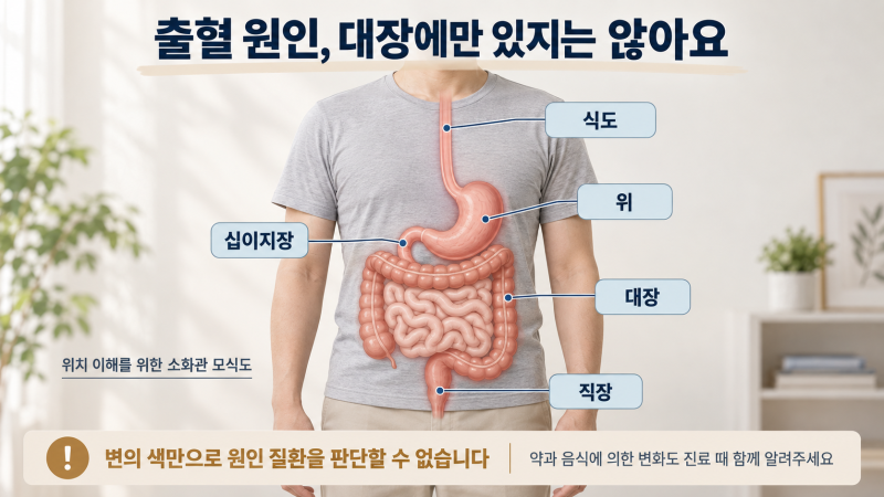 [대장암 대변상태] 혈변과 가는 변, 치질과 헷갈리지 않는 핵심 기준