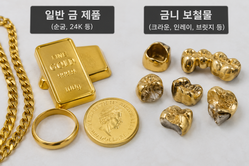 하남금니(금이빨)"왜 인터넷에는 정확한 가격이 없을까"