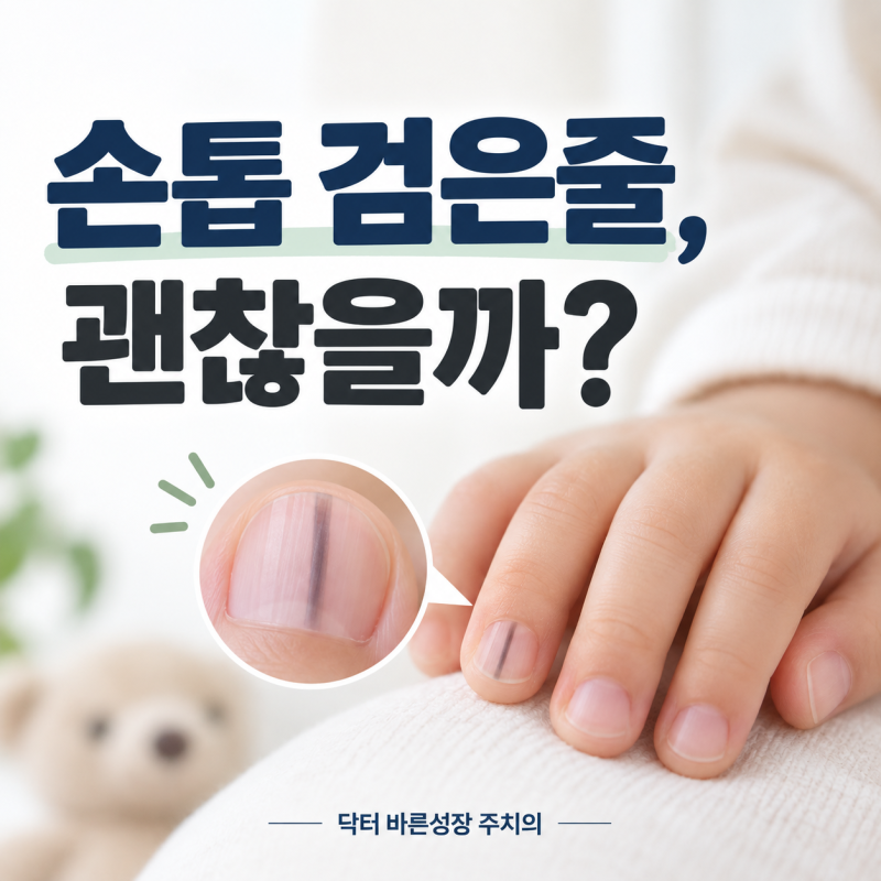 아이 손톱 검은 세로줄 원인, 소아 흑색조갑증과 흑색종 차이