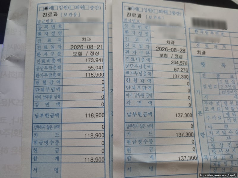 매복 사랑니 4개 발치 후기·비용, 어지럼증과 구토 치과 마취 부작용 경험담