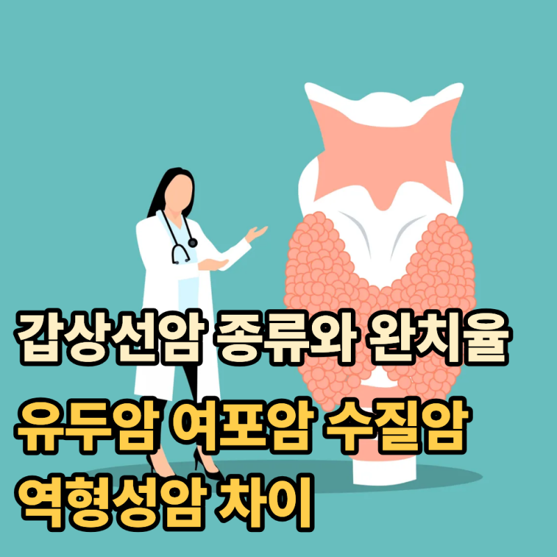 갑상선암 종류와 완치율, 유두암·여포암·수질암·역형성암 차이
