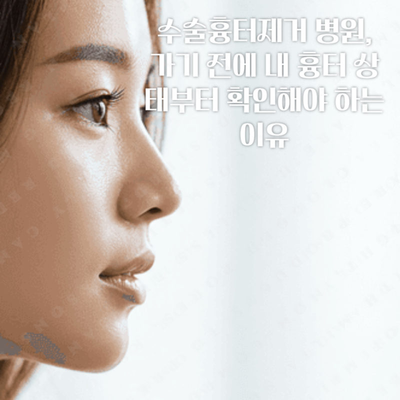 수술흉터제거 병원, 가기 전에 내 흉터 상태부터 확인해야 하는 이유