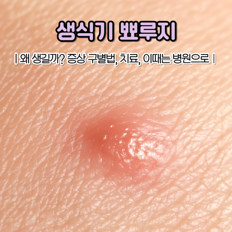 갑자기 생식기에 뾰루지가 생겼다면? 원인 증상 치료법