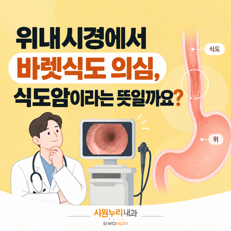 위내시경에서 바렛식도 의심, 식도암이라는 뜻일까요?