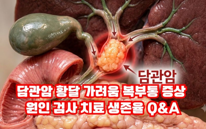 담관암 황달 가려움 증상 원인 검사 치료 생존율 명의 Q&A
