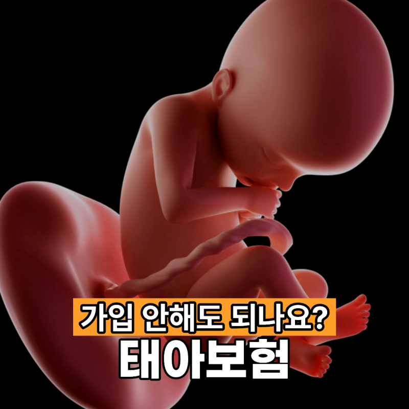 태아보험 가입 안해도 되나요?