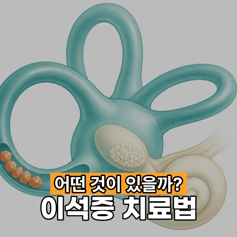 이석증 치료법 어떤 것이 있을까?