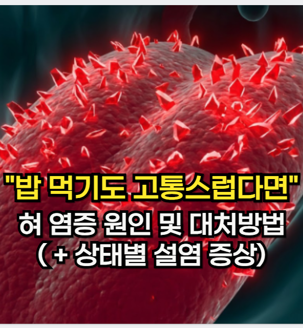 혀 염증 원인, "피곤할 때 밥 먹기도 고통스럽다면" 혀 상태별 설염 증상 및 대처 방법