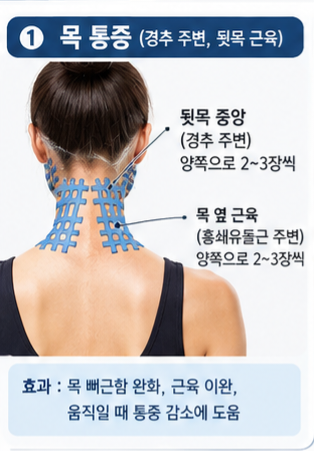 격자테이프 붙이는 위치｜목디스크·어깨·팔·등·허리 통증별 사용법