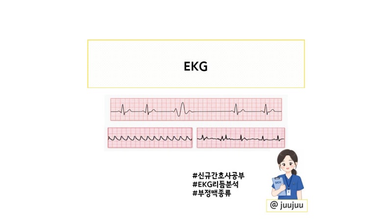 그림으로 배우는 EKG 리듬, 부정맥 완전 정복 !