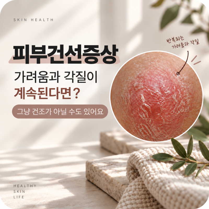피부건선증상, 가려움과 각질이 계속된다면 그냥 건조가 아닐 수도 있어요