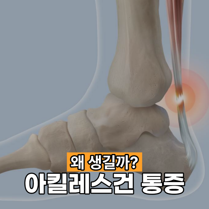아킬레스건 통증 왜 생길까?