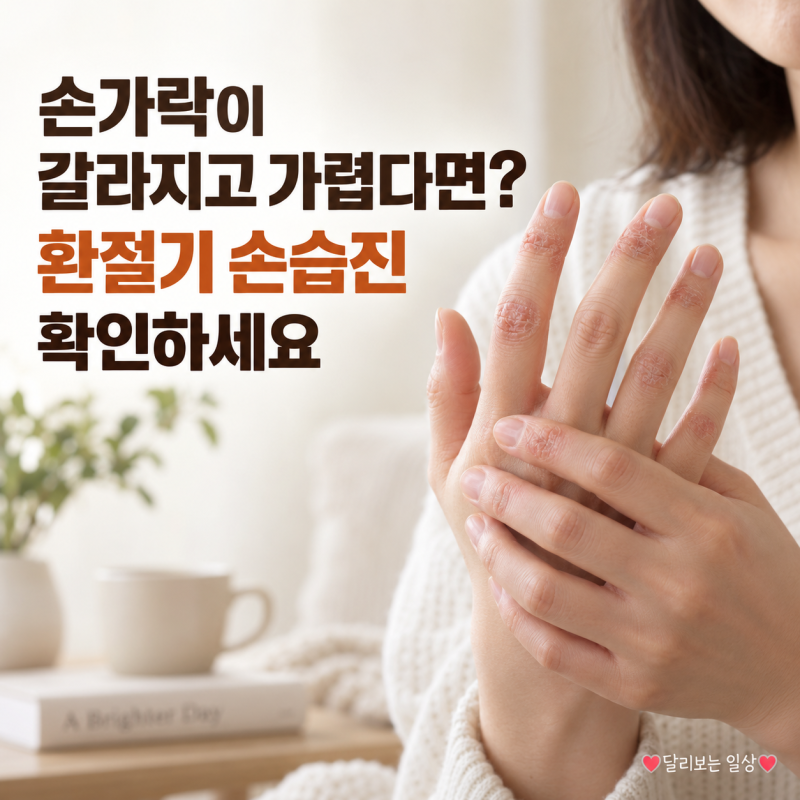 손가락이 갈라지고 가렵다면? 환절기 손습진 증상과 한포진·무좀 차이