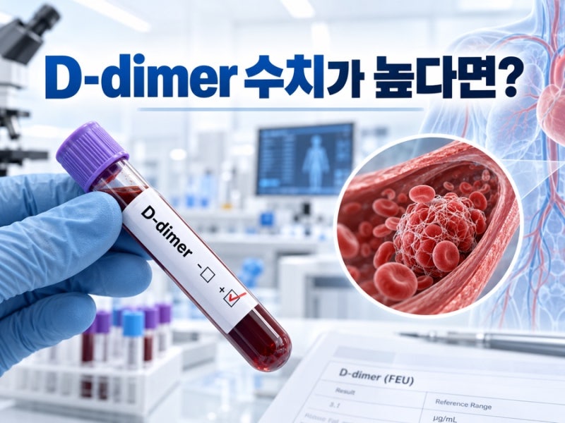 건강검진 D-dimer 수치가 높다면? 혈전 검사 해석하는 법