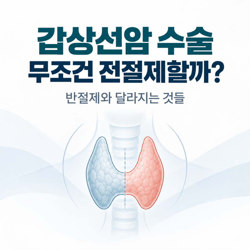 갑상선암 수술 전 꼭 물어봐야 할 8가지