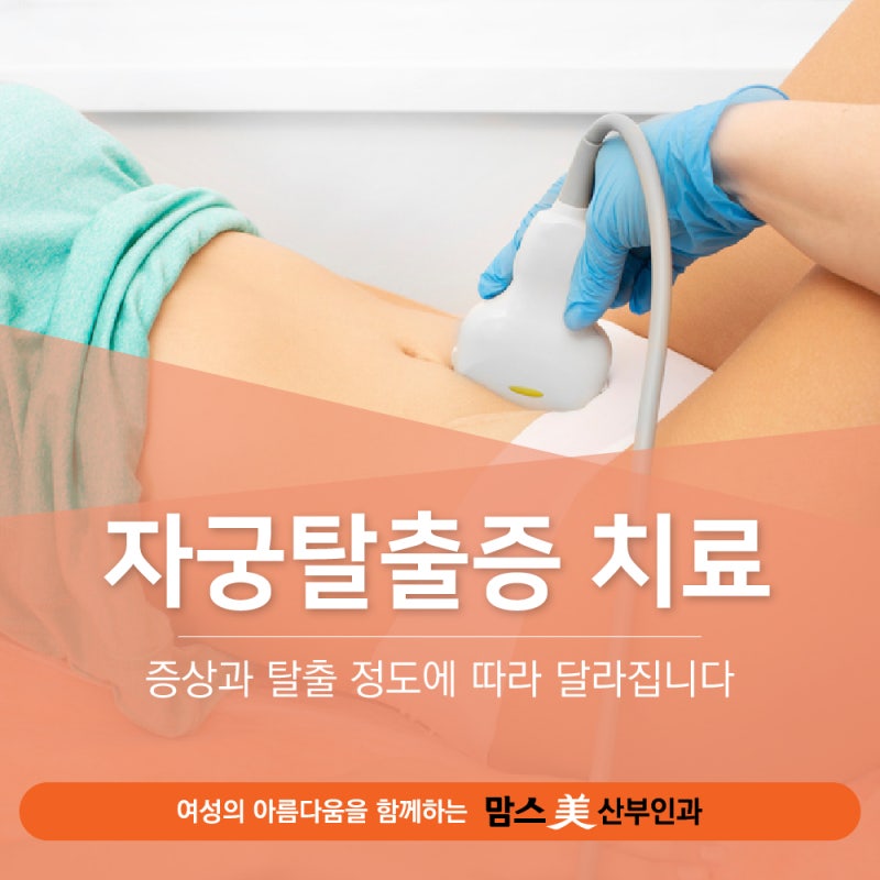 구산동 산부인과 자궁탈출증 치료, 꼭 수술해야 하는 건 아닙니다