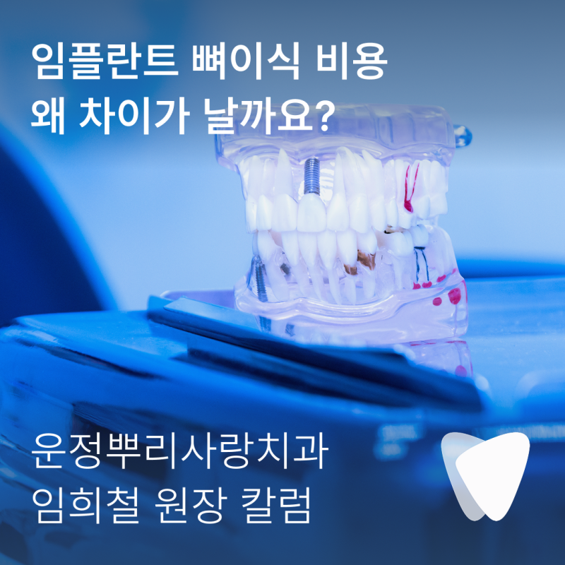 임플란트 뼈이식 비용, 같은 뼈이식인데 왜 다를까요?