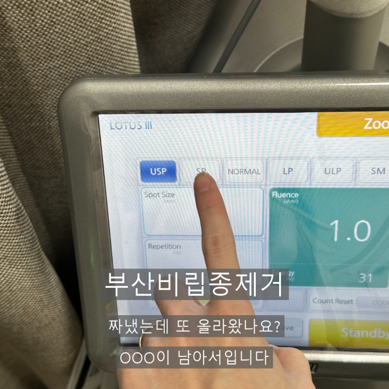부산비립종제거 짜냈는데 또 올라왔나요? OOO이 남아서입니다
