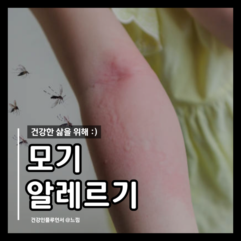 스키터증후군 증상 모기 알레르기 물집 붓기 병원
