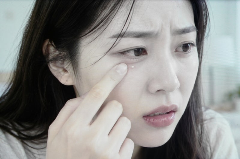 눈 비립종 원인 제거 방법, 눈가에 생기는 이유는?