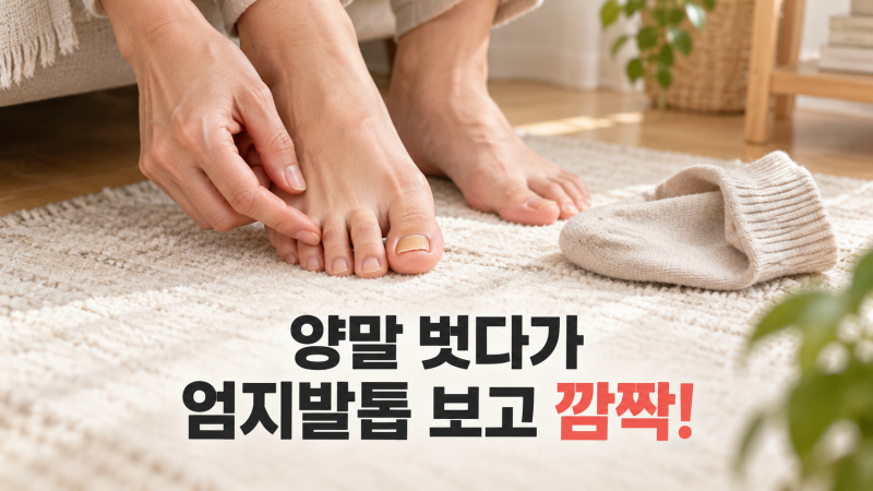 엄지발톱이 노랗고 갈라진다면? 무좀과 가로줄, 그냥 넘기면 안 되는 이유