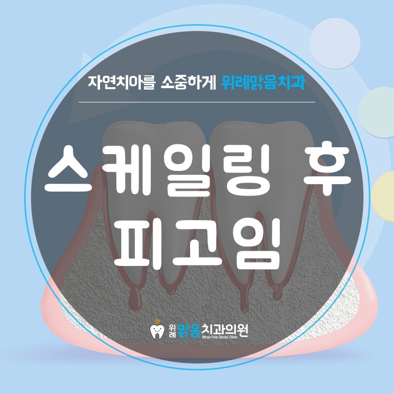 위례치과 :: 스케일링 후 피고임, 잇몸에 피가 고이는 이유는?