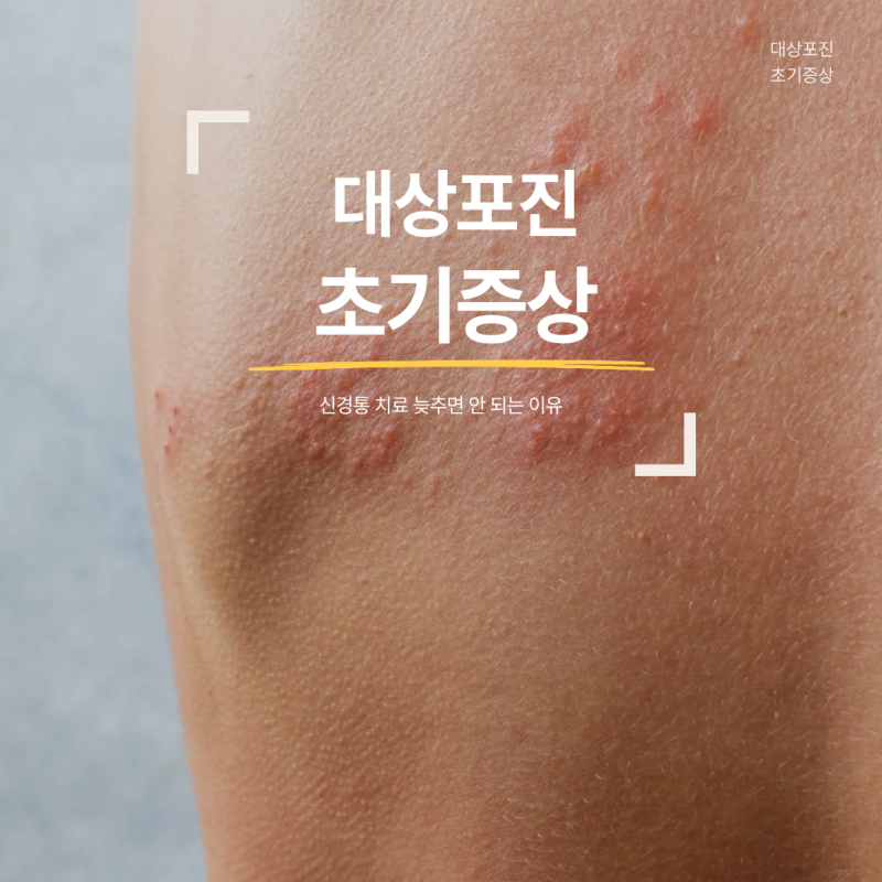 대상포진 초기증상 끝난 줄 알았는데 신경통 치료 늦추면 안 되는 이유