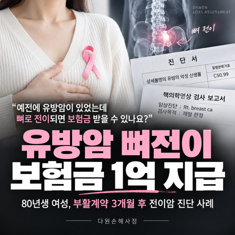 유방암 뼈전이 C50.99, 보험 부활 3개월 후 전이암 진단비 1억 지급 사례