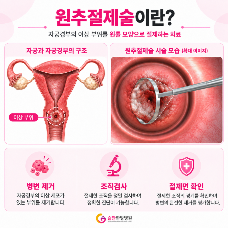 원추절제술 후 관리, HPV 검사부터 식단과운동, 후유증 까지 총정리
