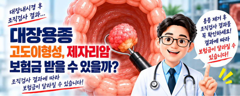 대장용종 고도이형성, 제자리암 보험금 받을 수 있을까?