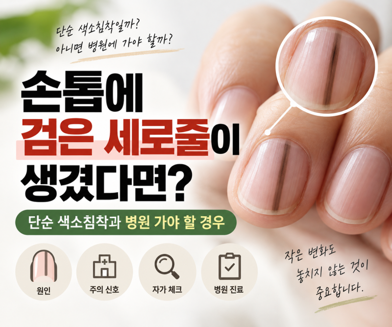 손톱에 검은 세로줄이 생겼다면? 단순 색소침착과 병원 가야 할 경우