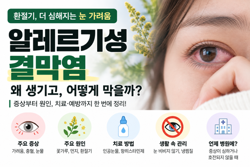 요즘 눈이 가렵고 충혈된다면? 알레르기성 결막염 증상·원인·대처법